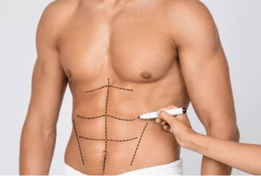 men procedure abdominal etching orlando florida