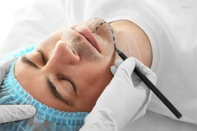Men’s facelift jawline definition