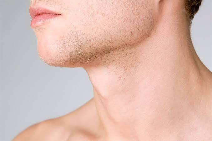 Men’s neck lift to improve neck contour and jawline definition.