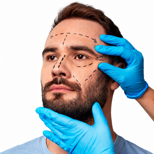 mens_eyelid_surgery10